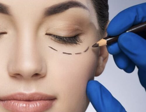 Is Tear Trough Filler the right treatment for you?