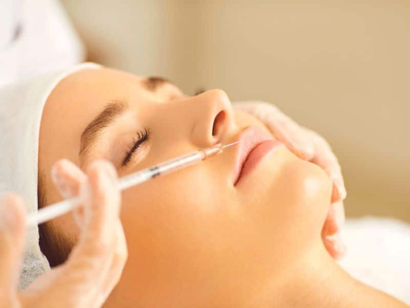 Do I Have a Filler Migration_featured