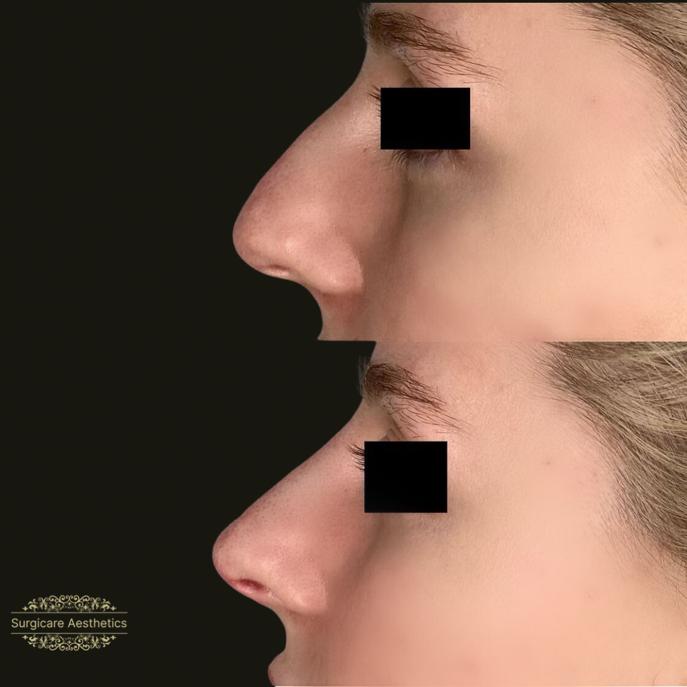 7dcb3ca8-bfd8-4cd3-9986-9d28effe7386