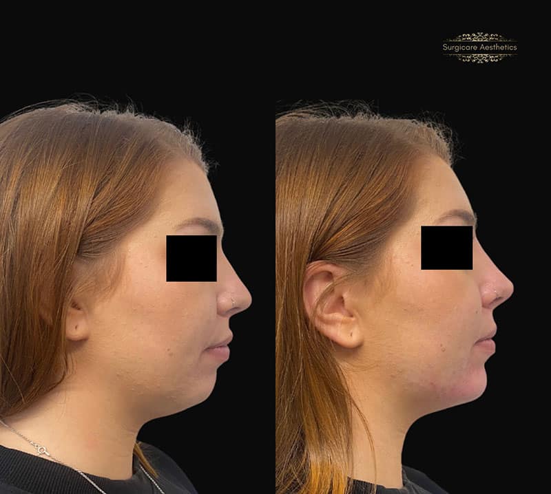 Why is the side profile so important?