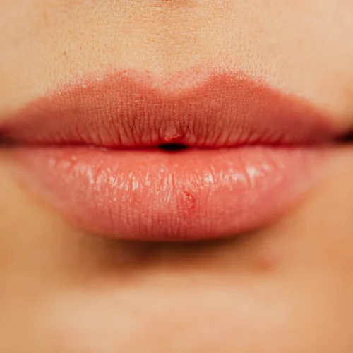 Glossy rosy lips close-up showcasing natural texture, subtle aging, and skincare benefits.