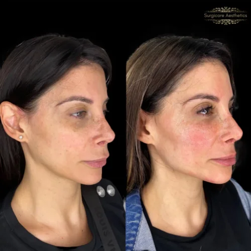 Before and After Beautification