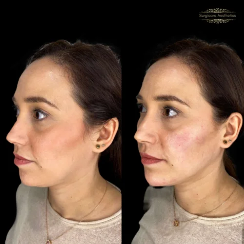 Before and after Beautification 1