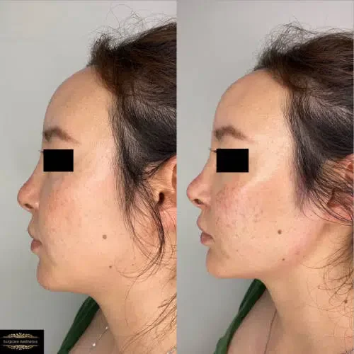 Before and after Beautification