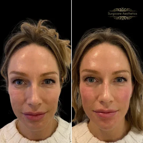 Before and after Beautification 2