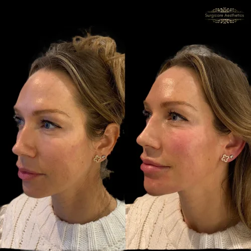 Before and after Beautification 3