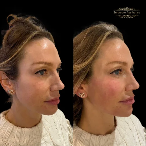 Before and after Beautification 4