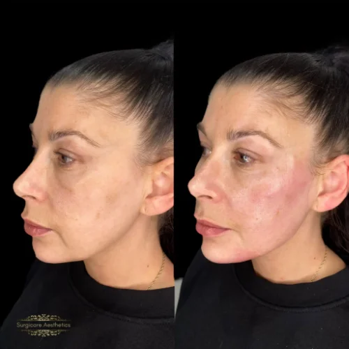 Before and after Beautification 7