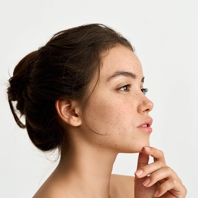 NASOLABIAL & MARIONETTE LINES filler PRICES