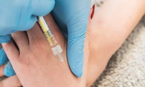 Rejuvenating the Forgotten Ageing Area