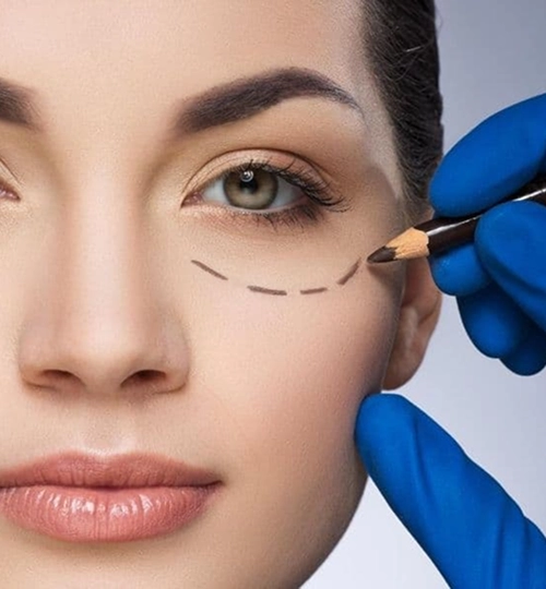 Restoring Brightness to Tired Eyes